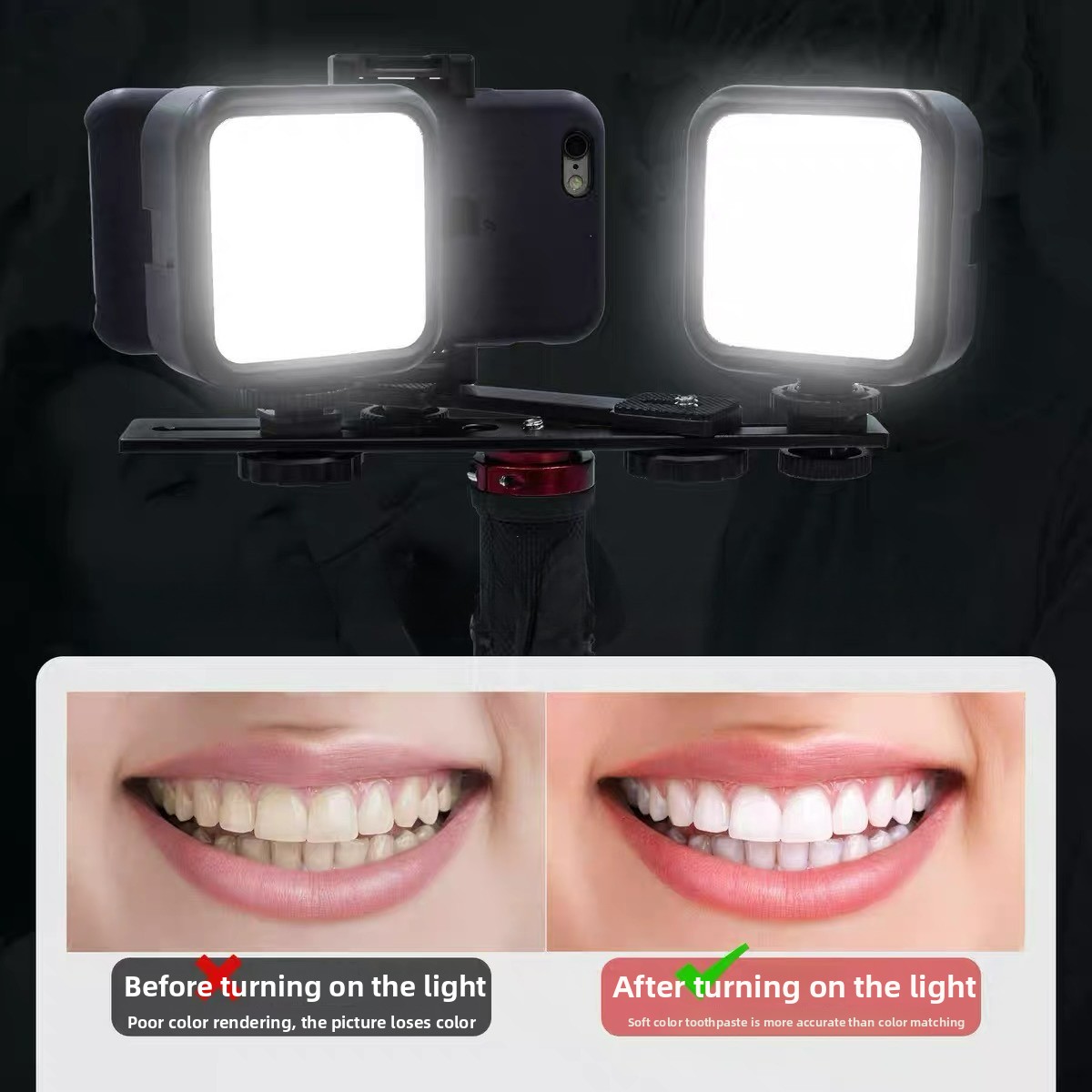 Dental Photography Light with  - Photography Mobile Lighting ulasan dan harga